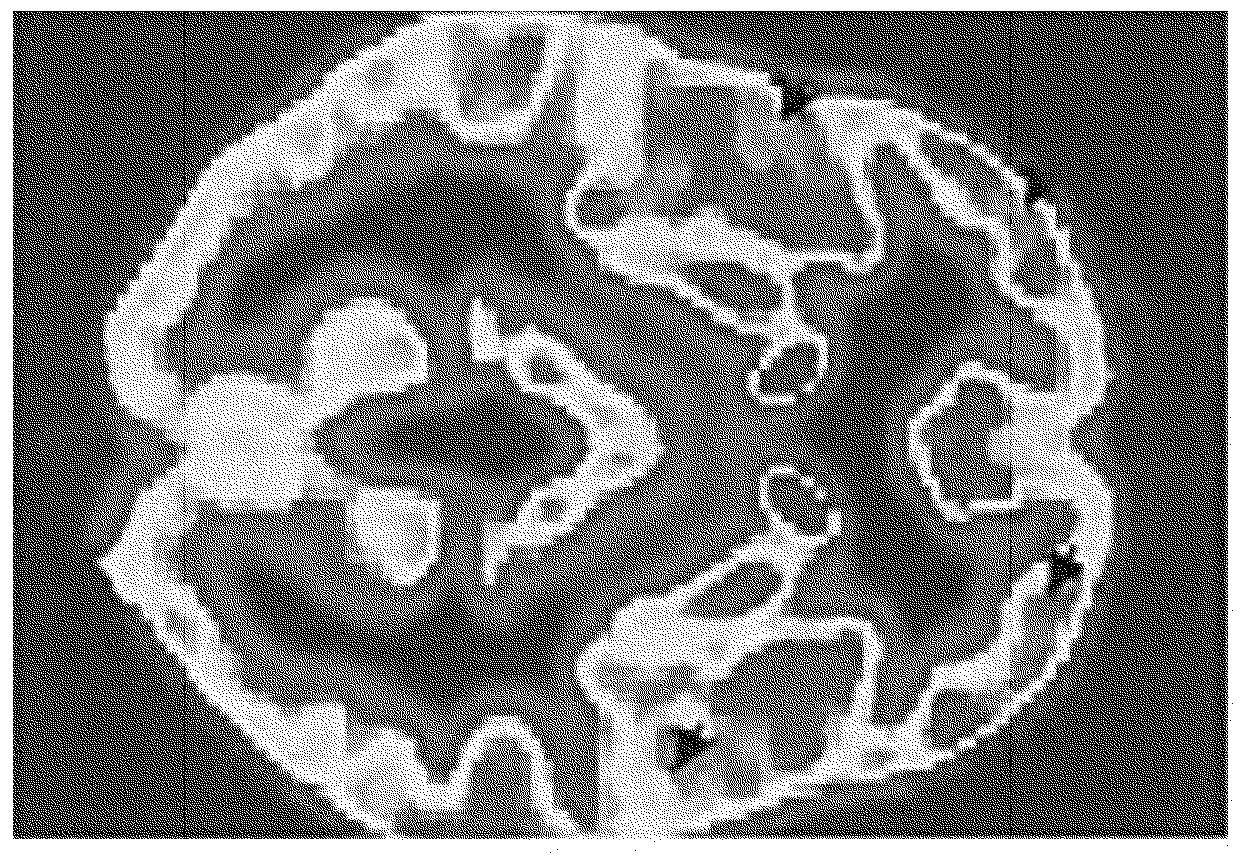 Botulinum toxin for primary disorders of mood and affect using neurotransmitter