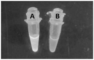 Detection primer, detection kit and detection method for clonorchis sinensis and application