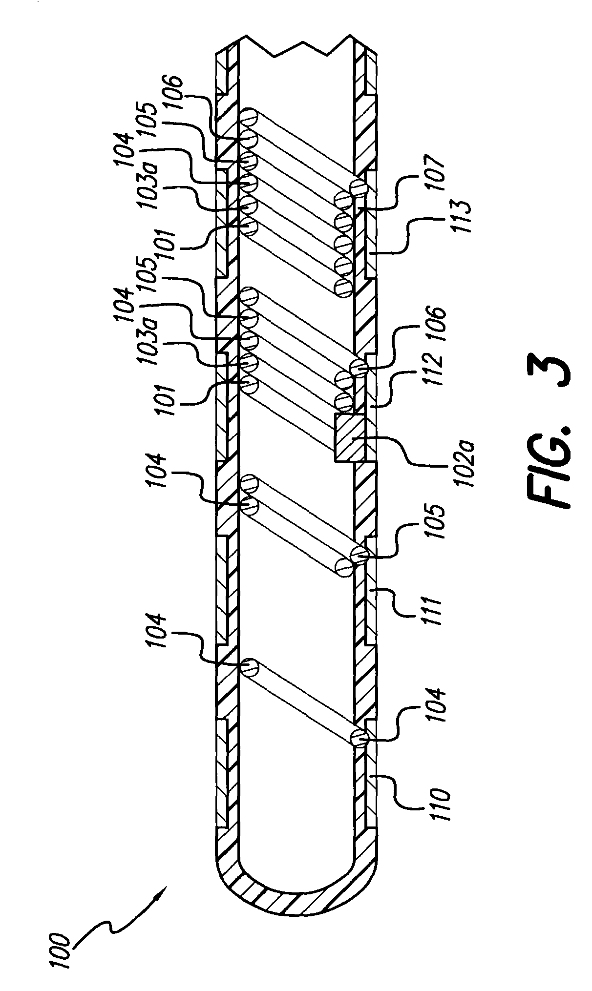 Brain stimulation lead used for lesioning