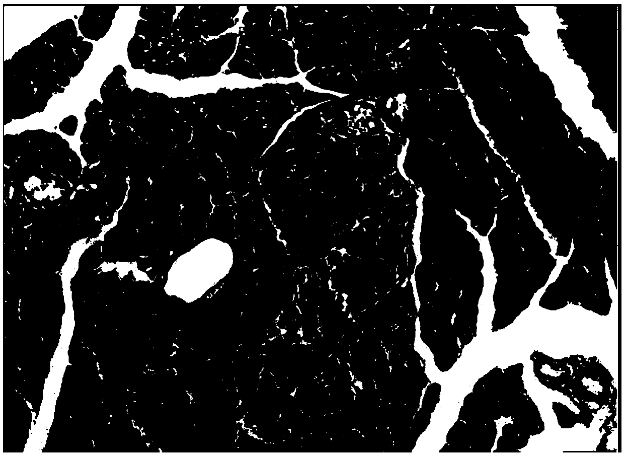 Application of pyrazolopyrimidine derivative for treating liver injury caused by acute pancreatitis