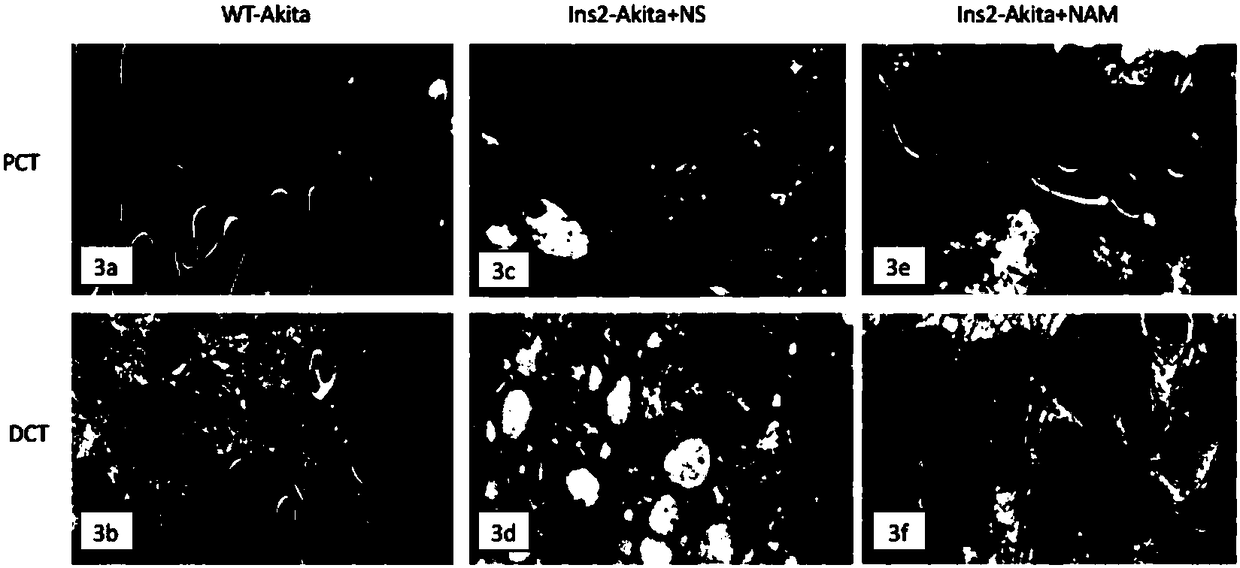 Application of nicotinamide (NAM) to preparation of drugs used for preventing and treating diabetic nephropathy and regulating blood pressure