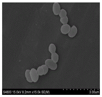 A kind of enterococcus faecium and preparation method thereof