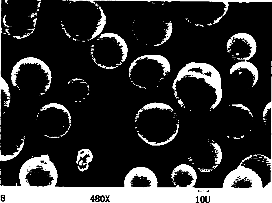 Preparation method of minocycline hydrochloride chitosan microsphere and application thereof