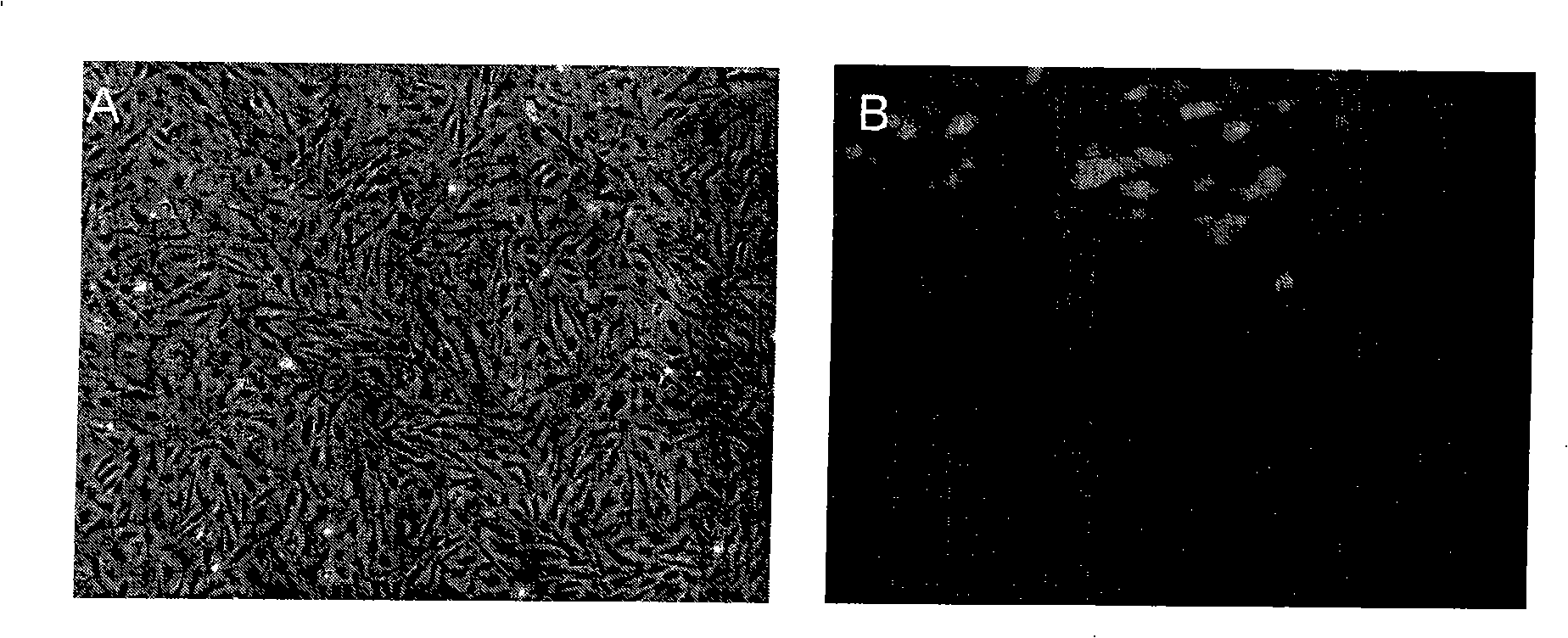 Method for preparing retina neural ganglia progenitor cells