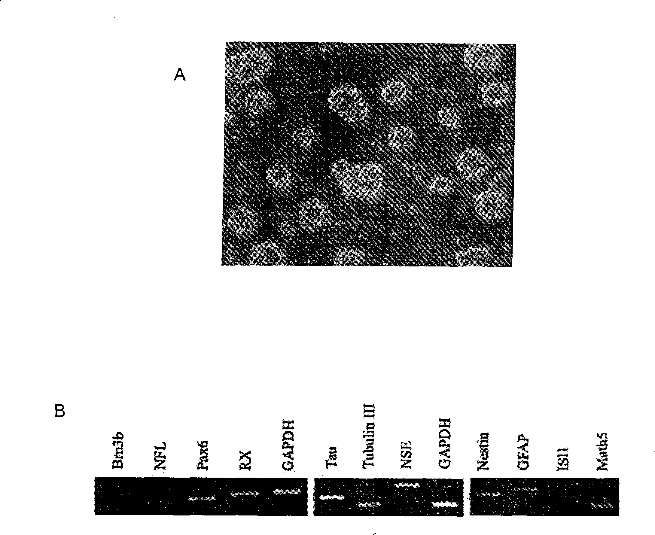 Method for preparing retina neural ganglia progenitor cells