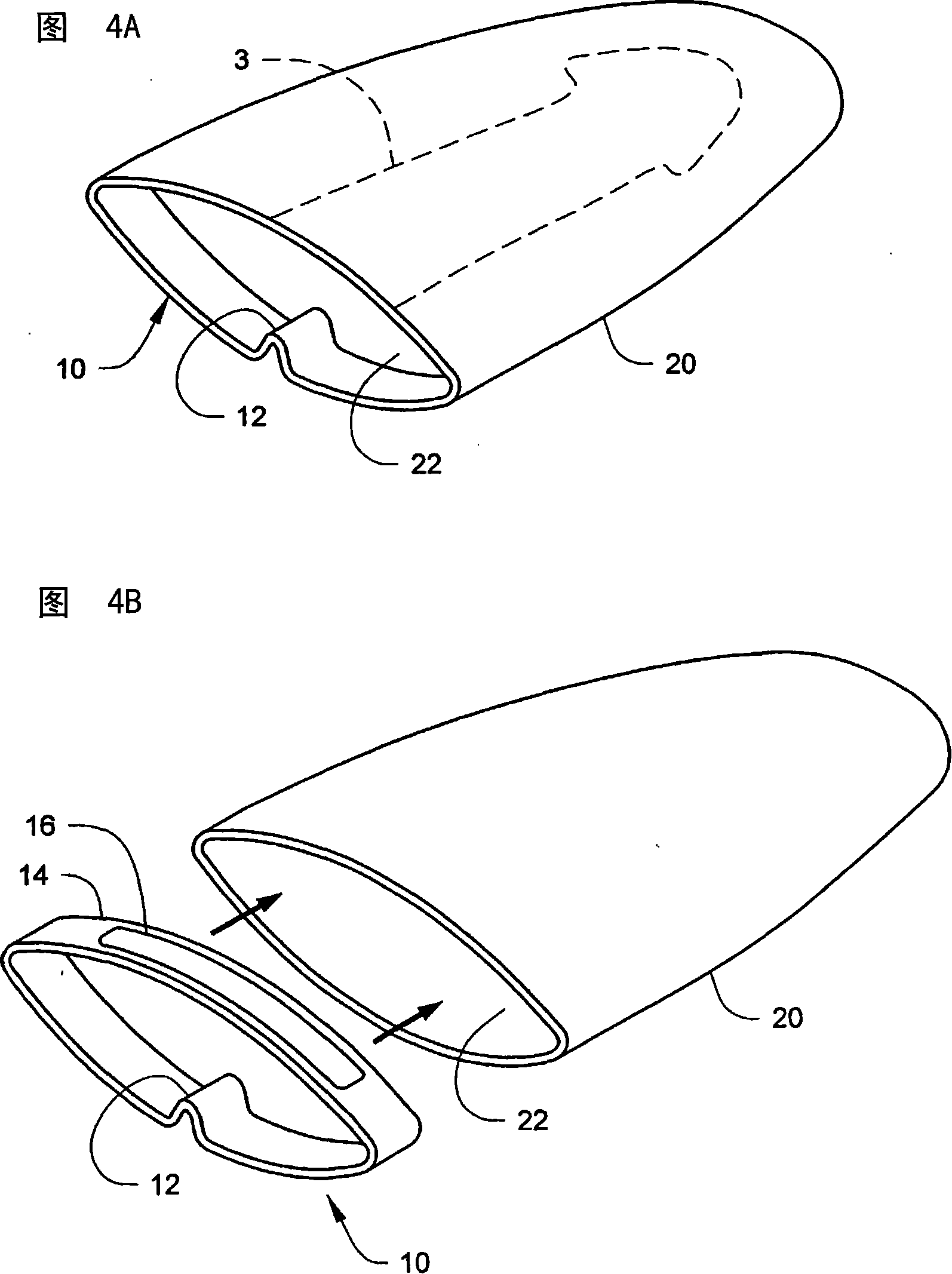 Penile compression device