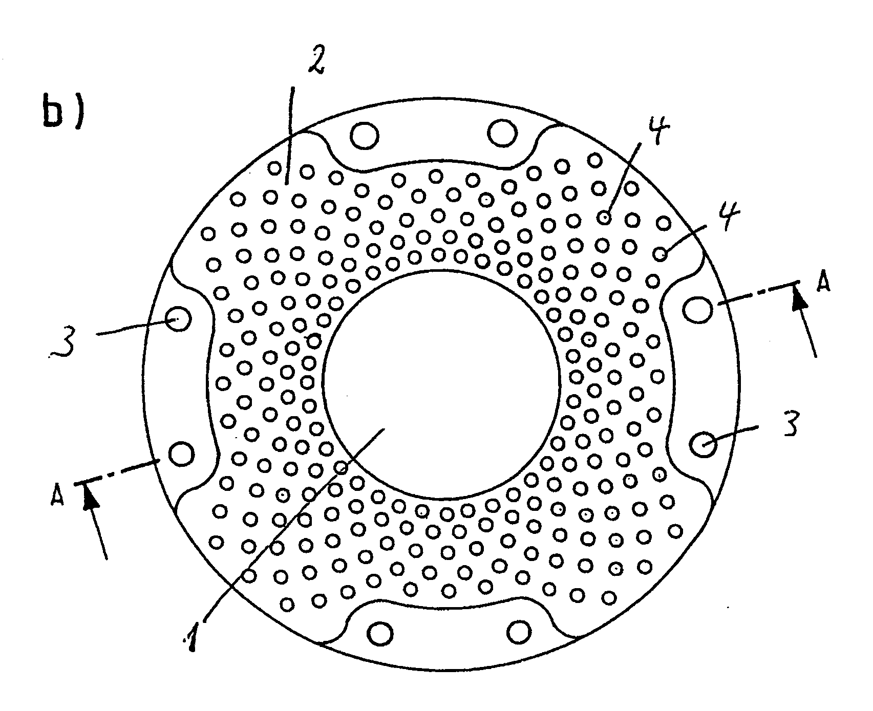 Keratoprosthesis