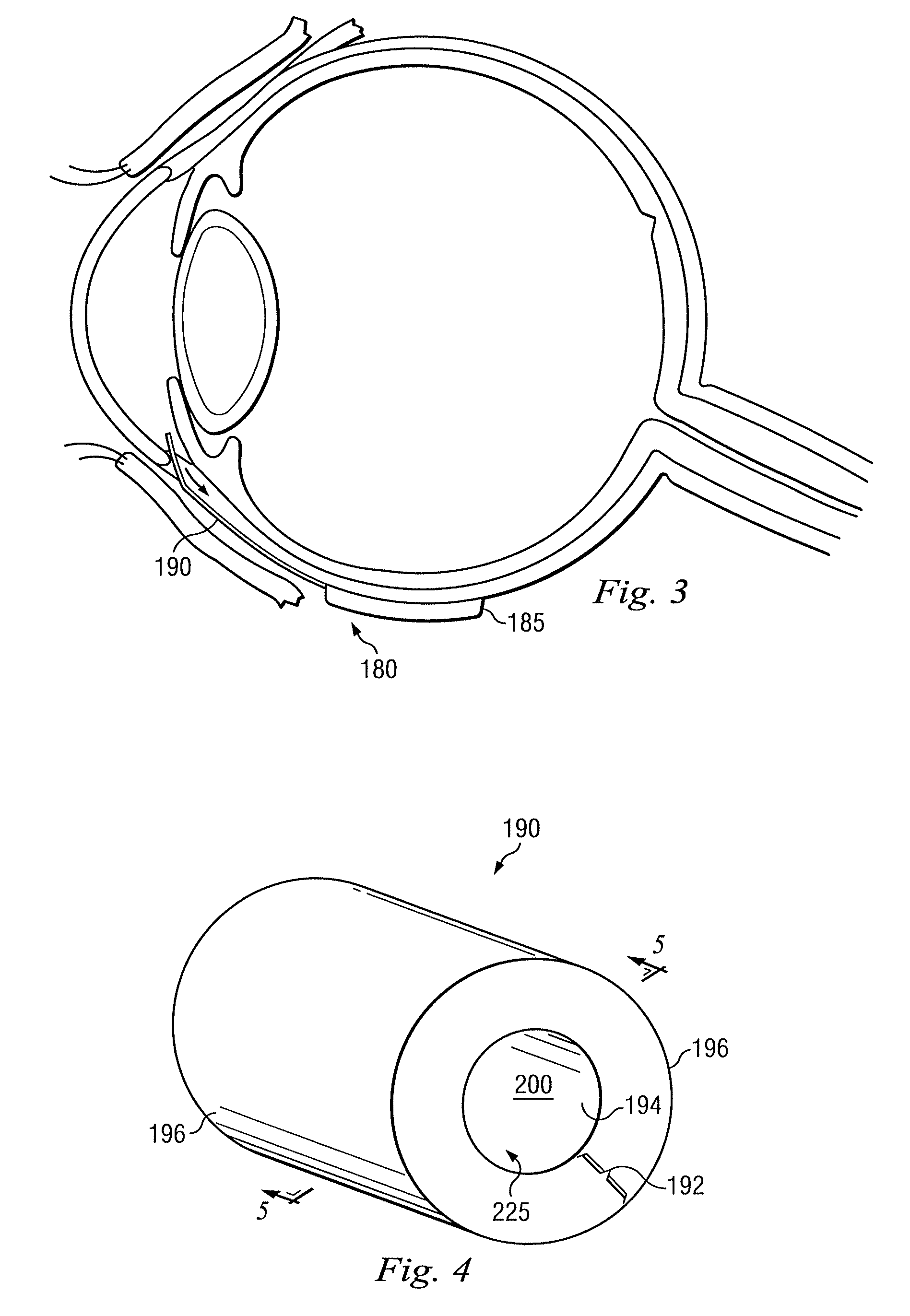 Functionally graded material tube and method for use of the same in implantation