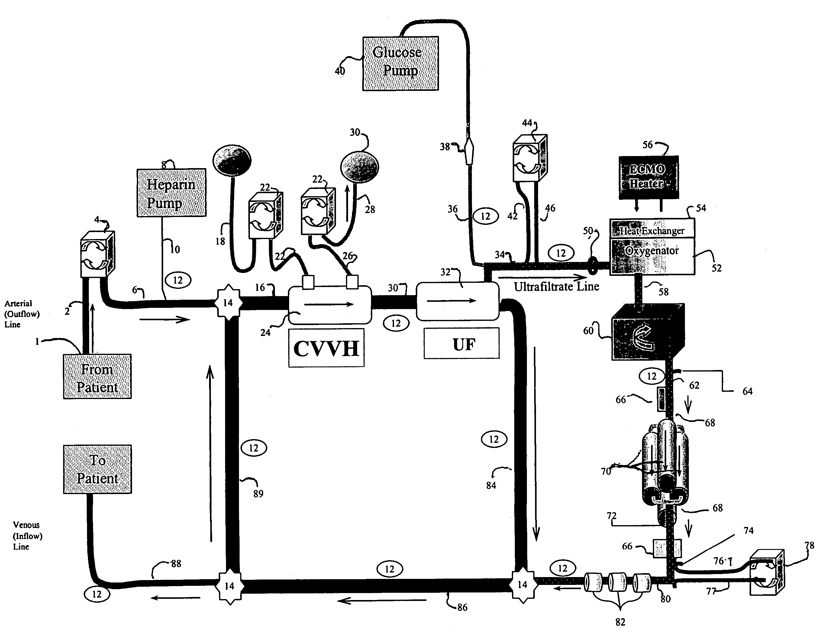 Modified organ support devices