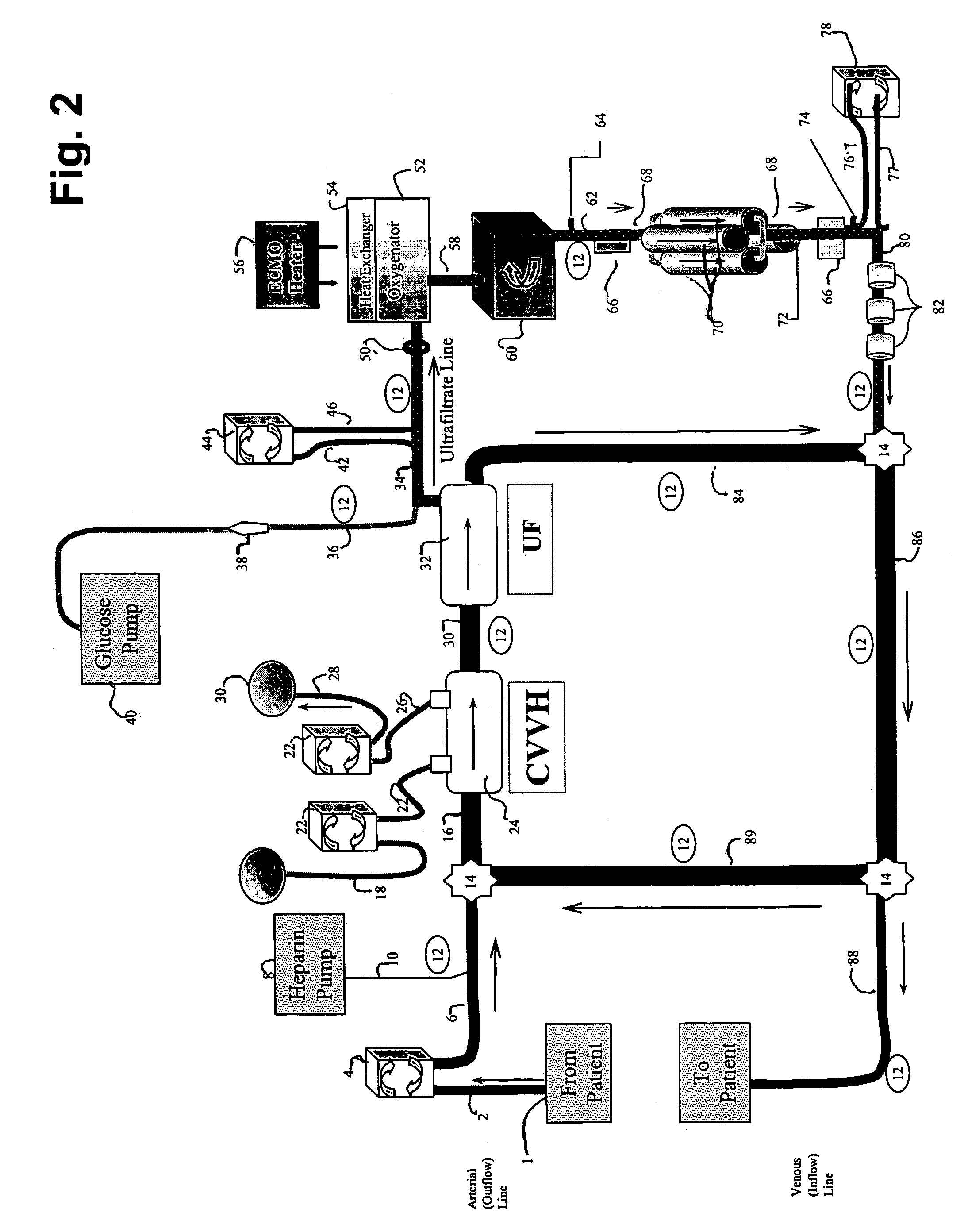 Modified organ support devices