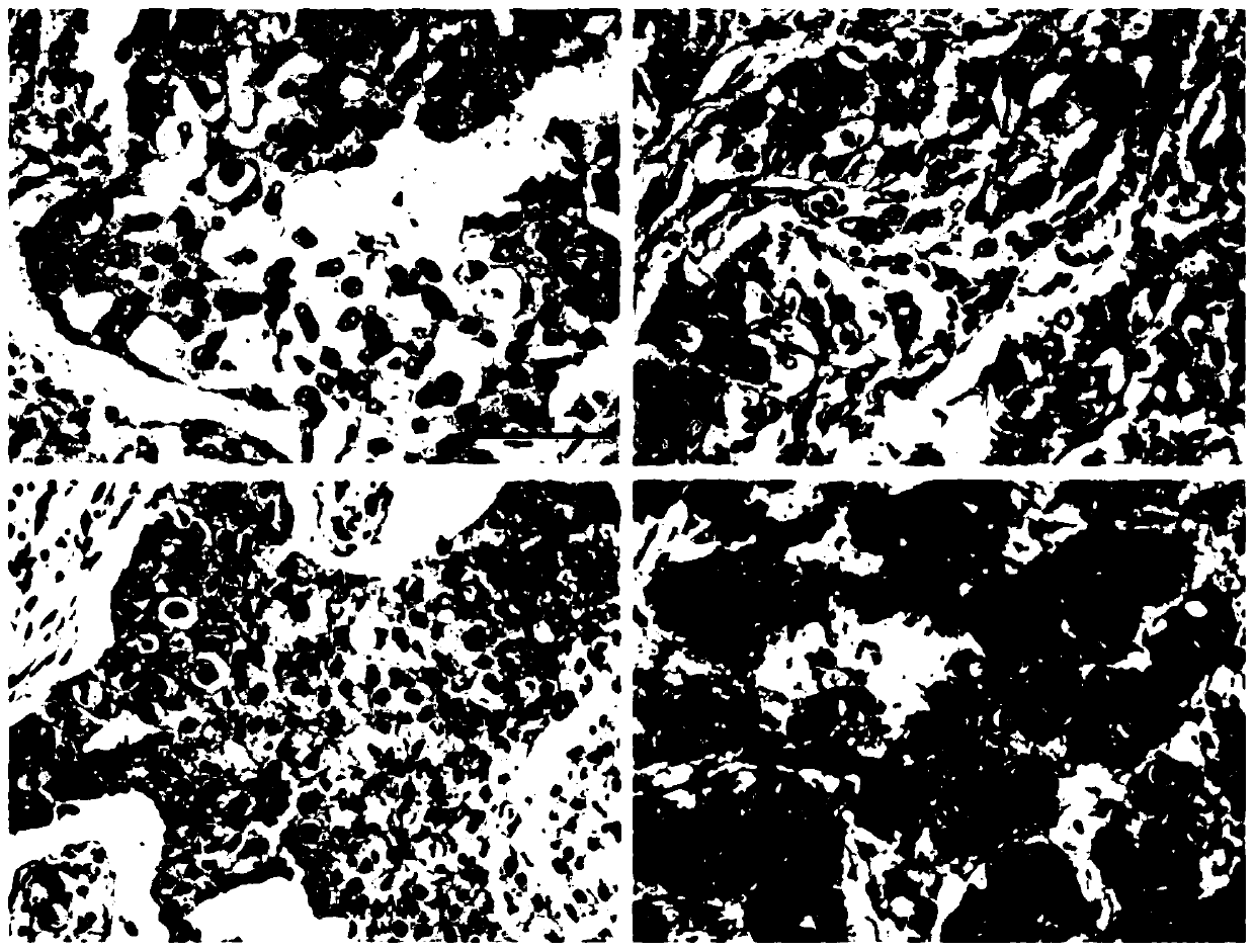 Establishment method of CXCR4 targeted drug treatment triple negative breast cancer platform