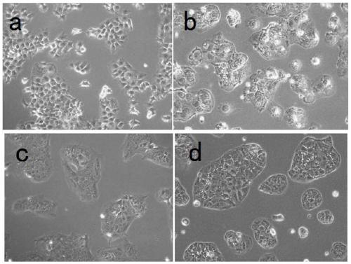 Human choriocarcinoma multidrug resistant cell lines