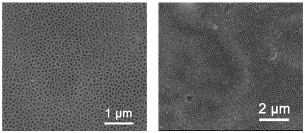 A pH-responsive in-situ controlled-release titanium-based implant and its preparation method and application