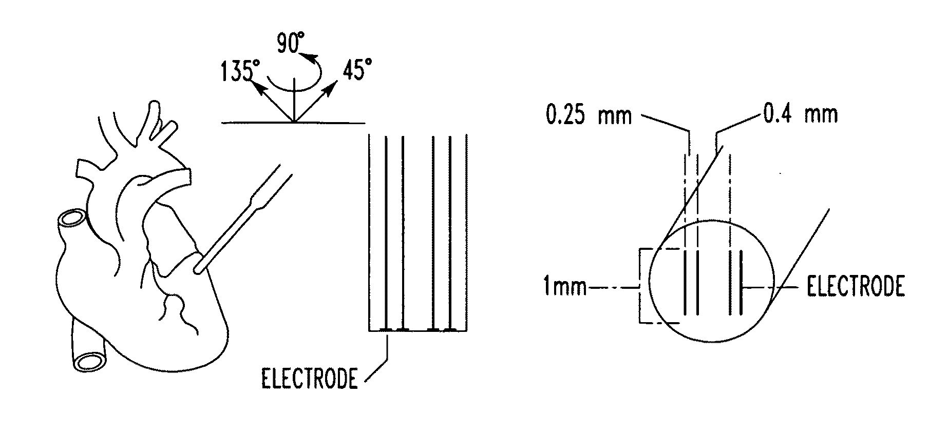 Method and apparatus for monitoring an organ of a patient