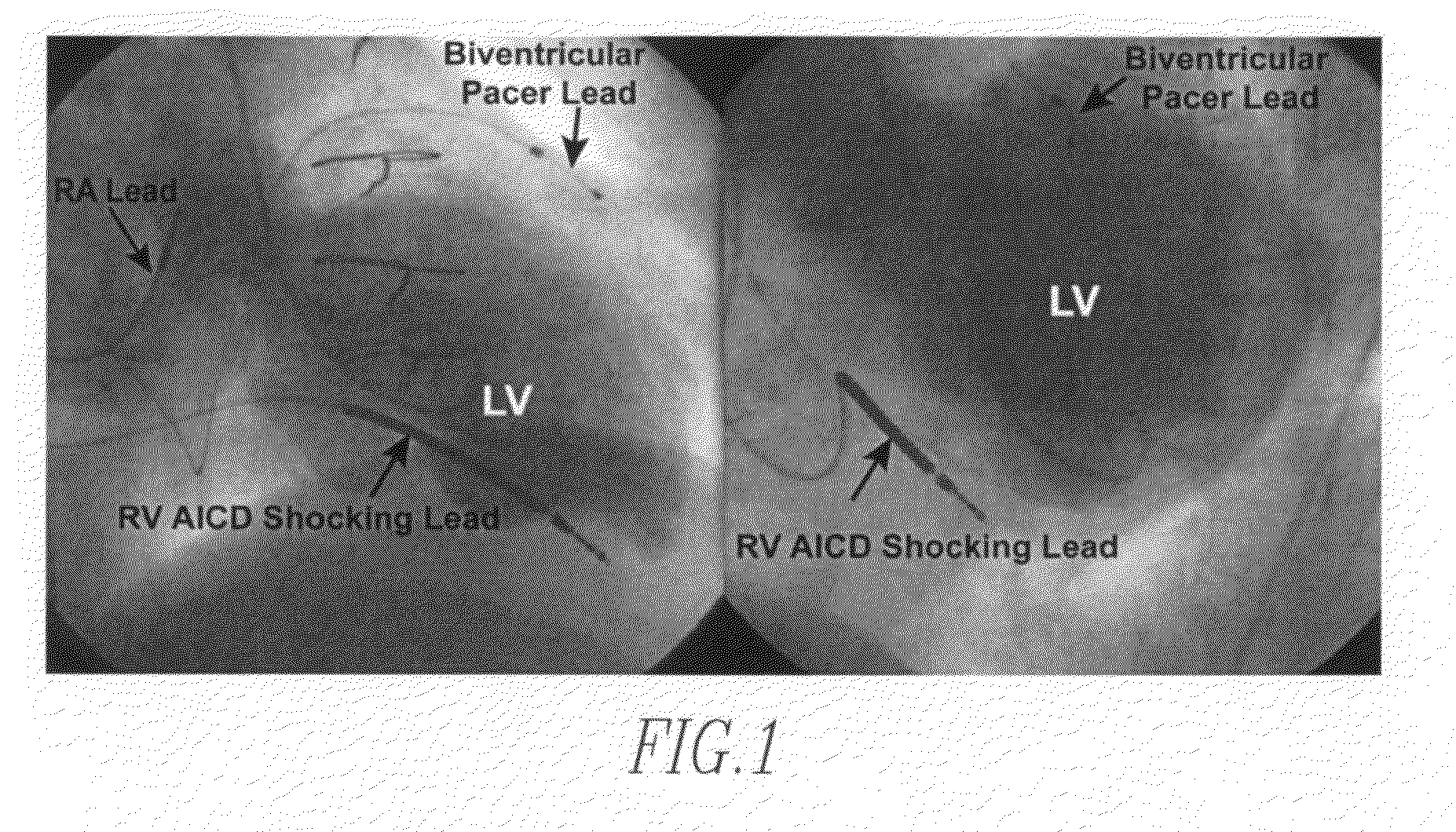 Method and apparatus for monitoring an organ of a patient