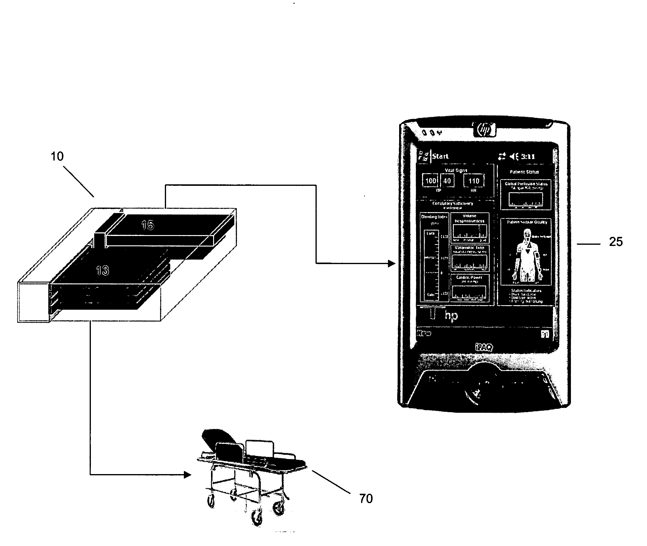 Device and system that identifies cardiovascular insufficiency