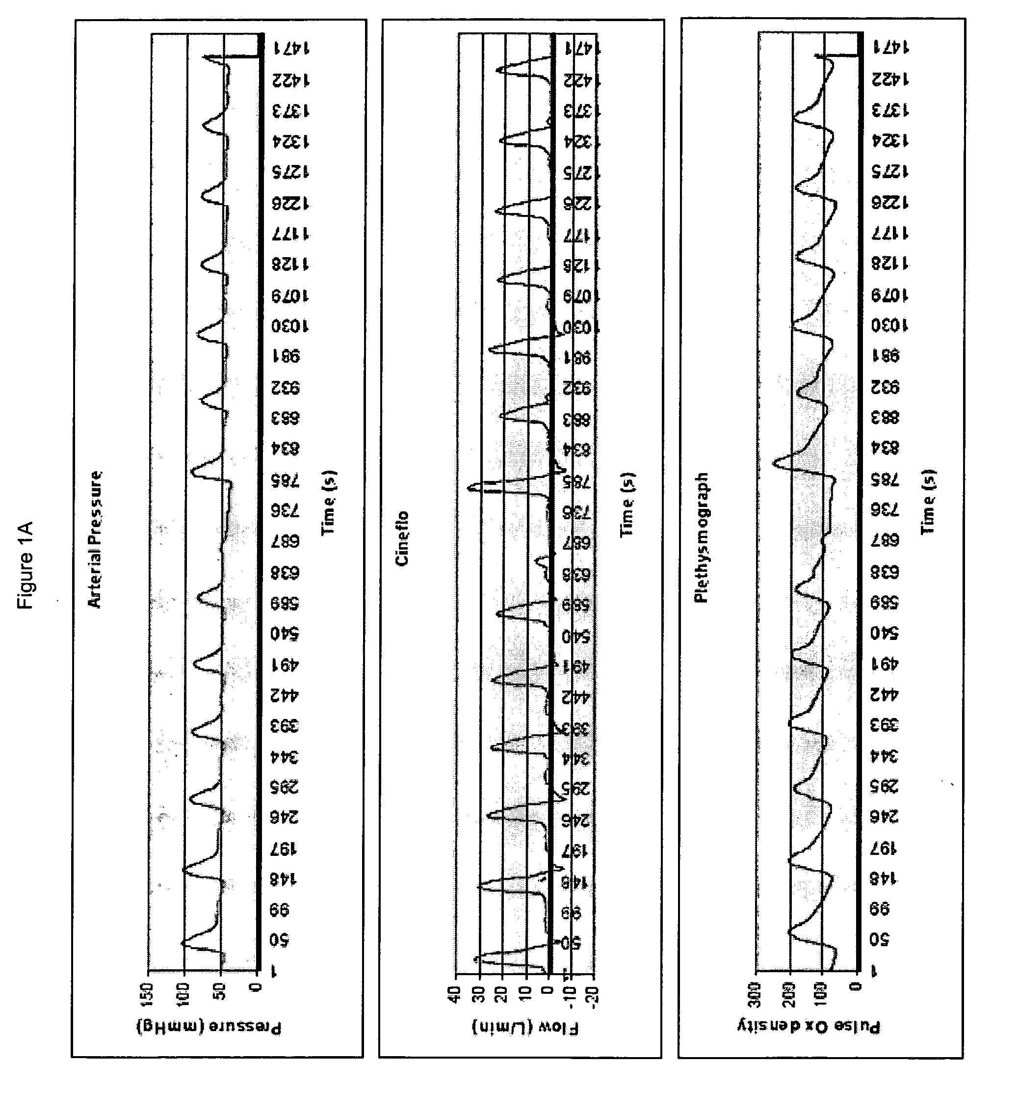 Device and system that identifies cardiovascular insufficiency