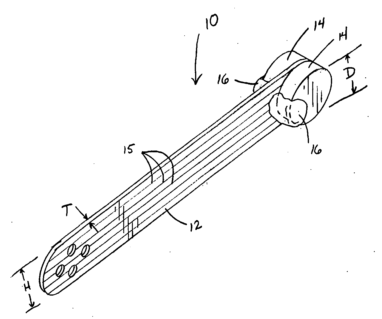 Method and apparatus for positioning an orthodontic appliance