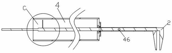 Deciduous tooth metal preformed crown model selection ruler