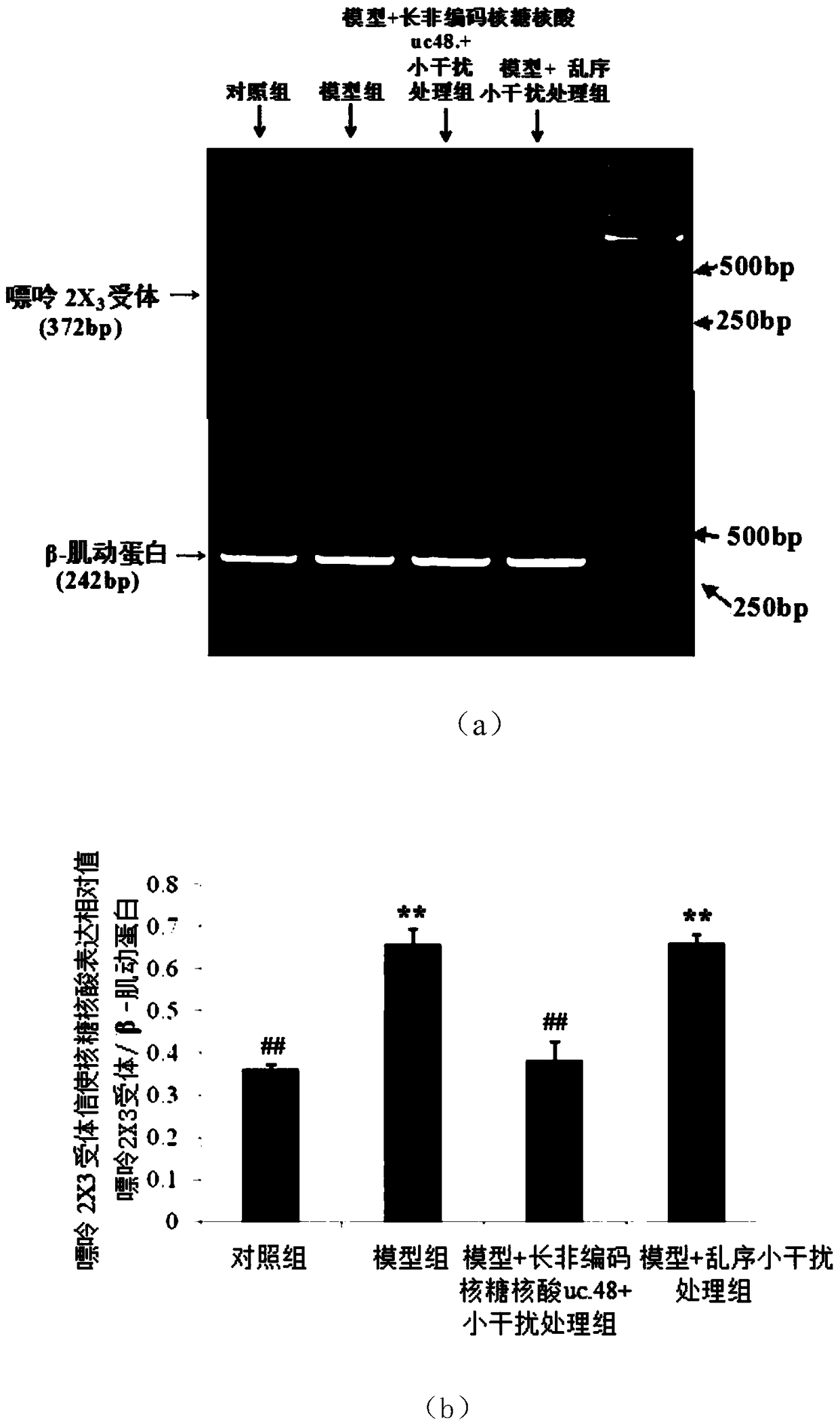 Application of long non-coding RNA uc.48+ small interfering RNA in the preparation of drugs for diabetic neuropathic pain