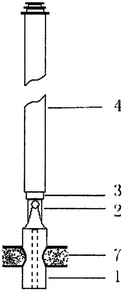 Single-channel elastic sheath and puncture releaser for laparoscopic surgery