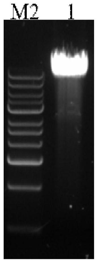 A method for preparing nanobodies against carcinoembryonic antigen