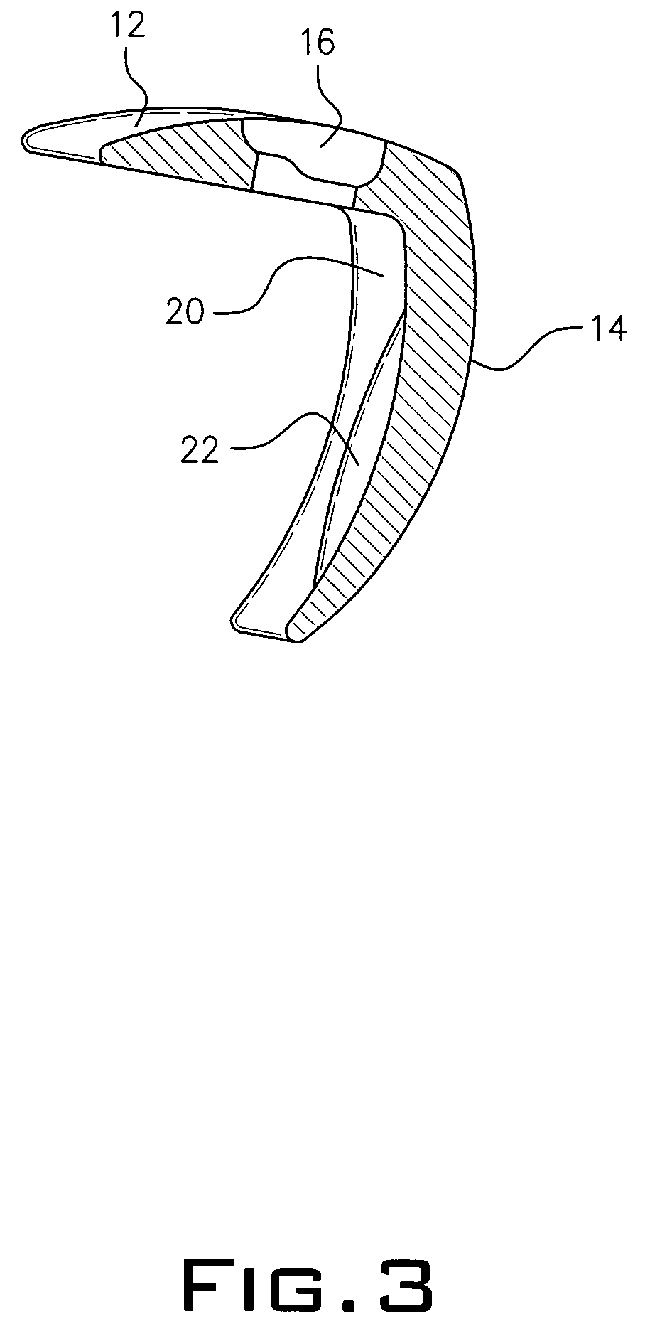 Metallic prosthetic implant for use in minimally invasive acromio-clavicular shoulder joint hemi-arthroplasty