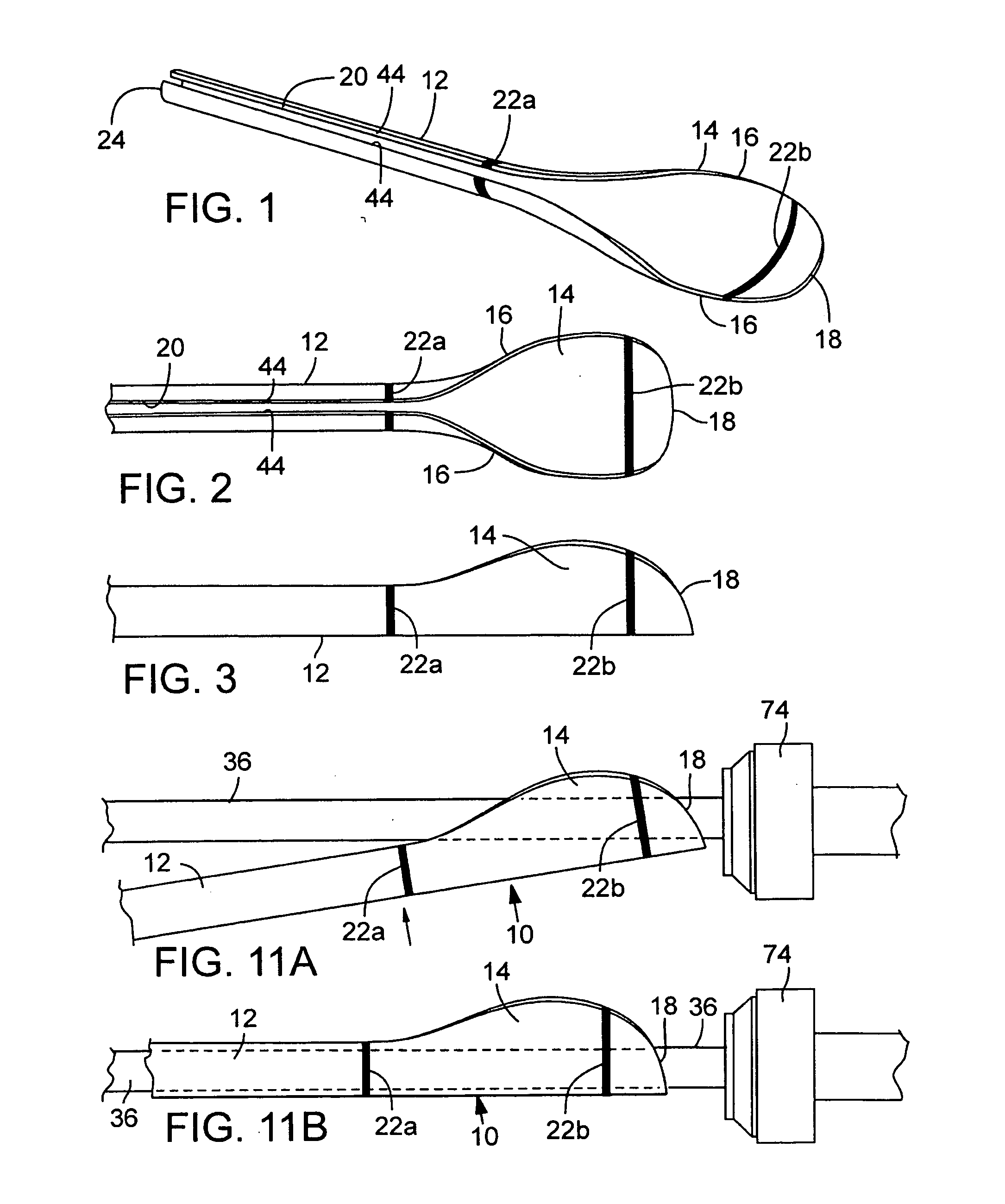 System for percutaneous delivery and removal of a prosthetic valve