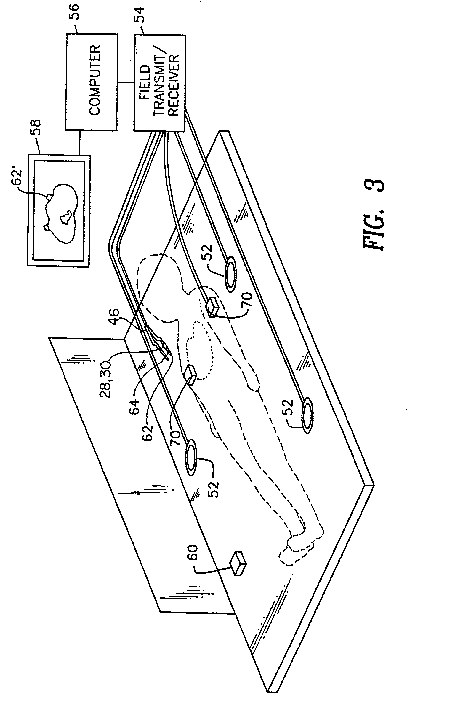 Medical probes with field transducers