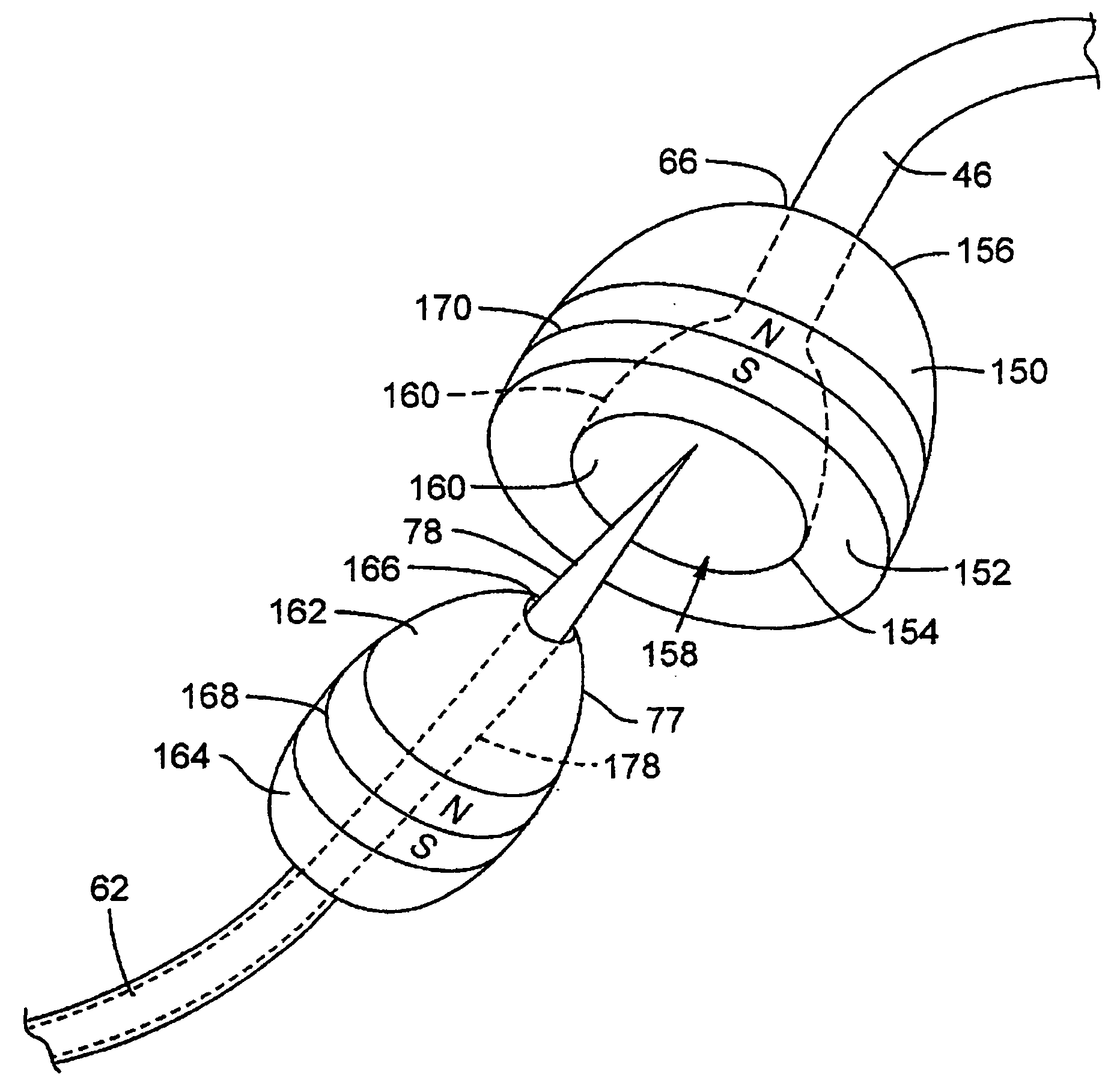 Catheter system for connecting adjacent blood vessels