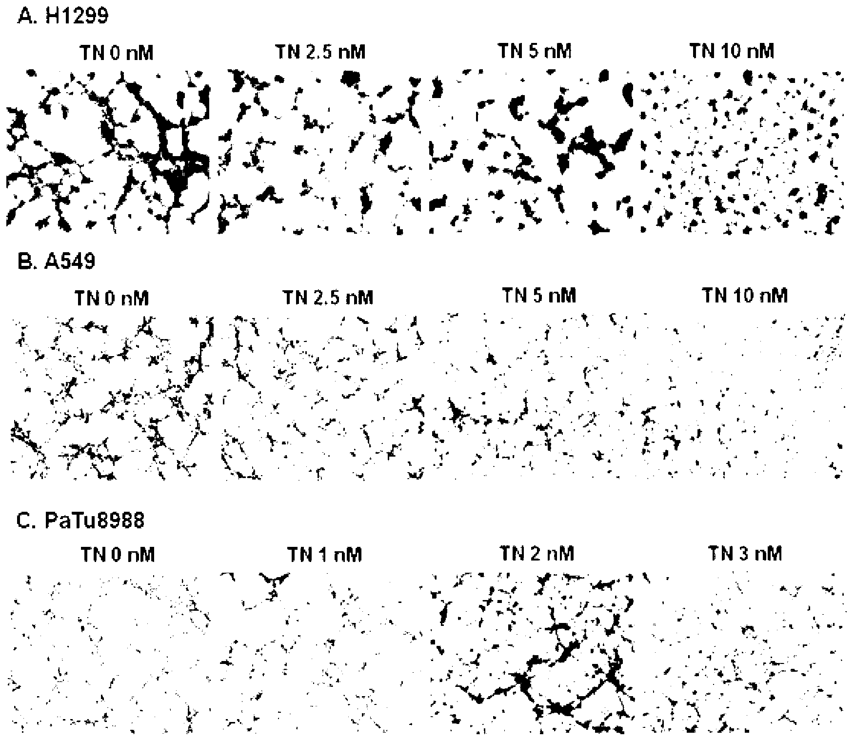 Application of triptonide to anti-angiogenesis drugs