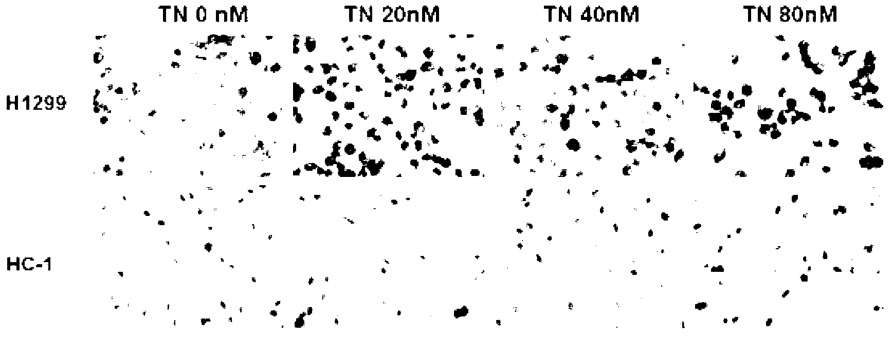 Application of triptonide to anti-angiogenesis drugs