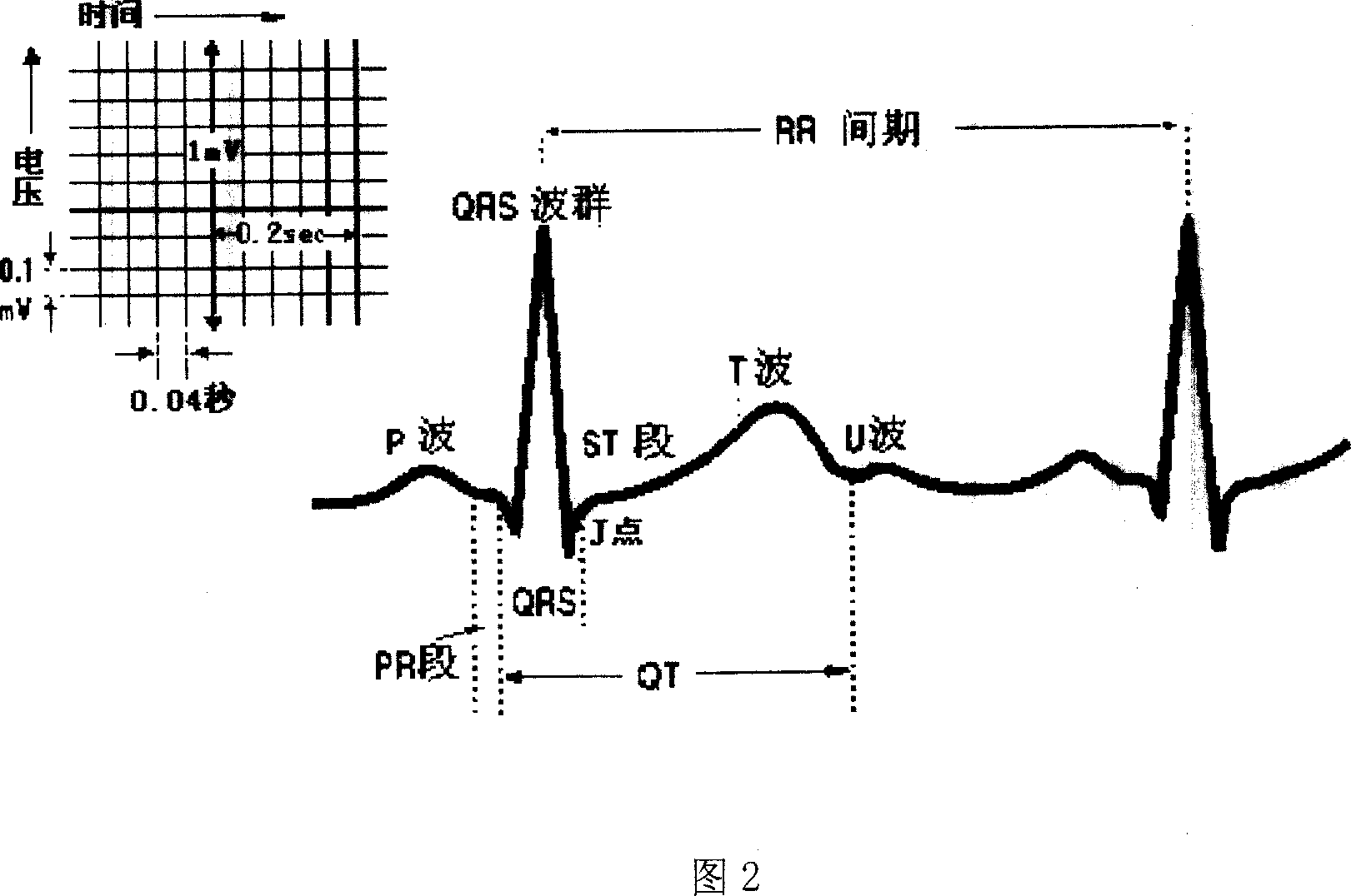 Method and apparatus for detecting, and analysing heart rate variation predication degree index