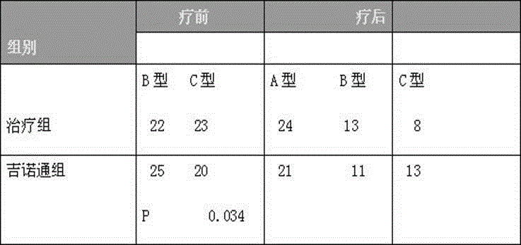 Drug compound for treating suppurative otitis media of children and preparation method thereof