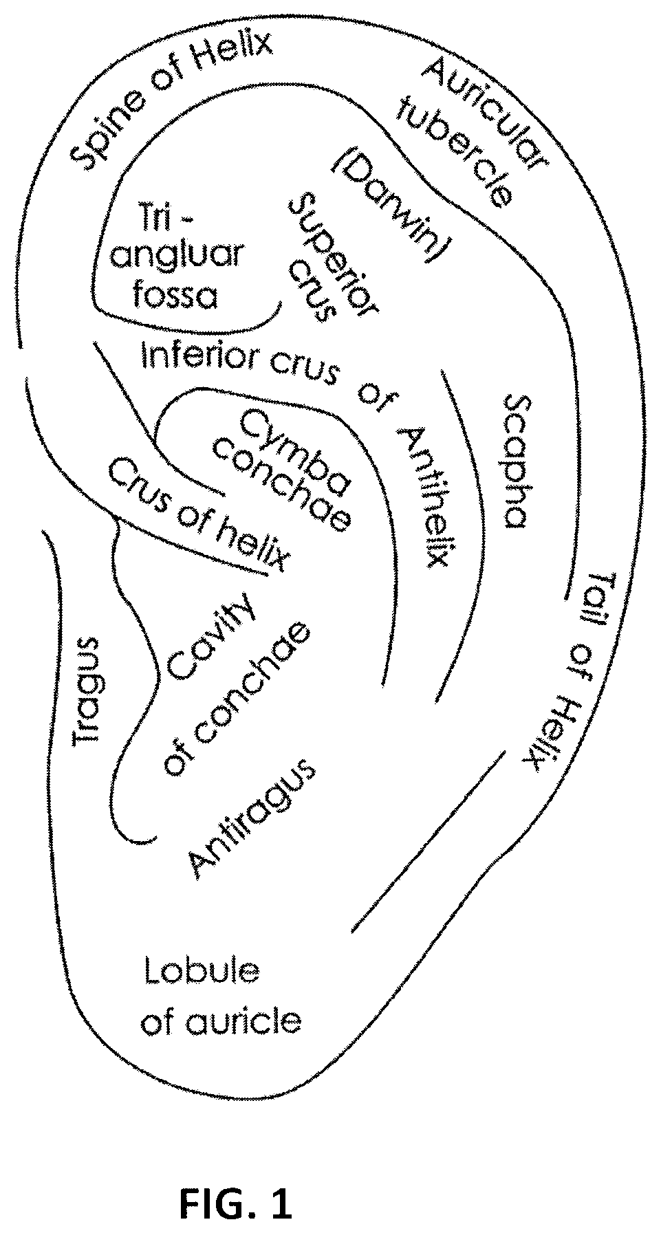 Treatment of bleeding by non-invasive stimulation