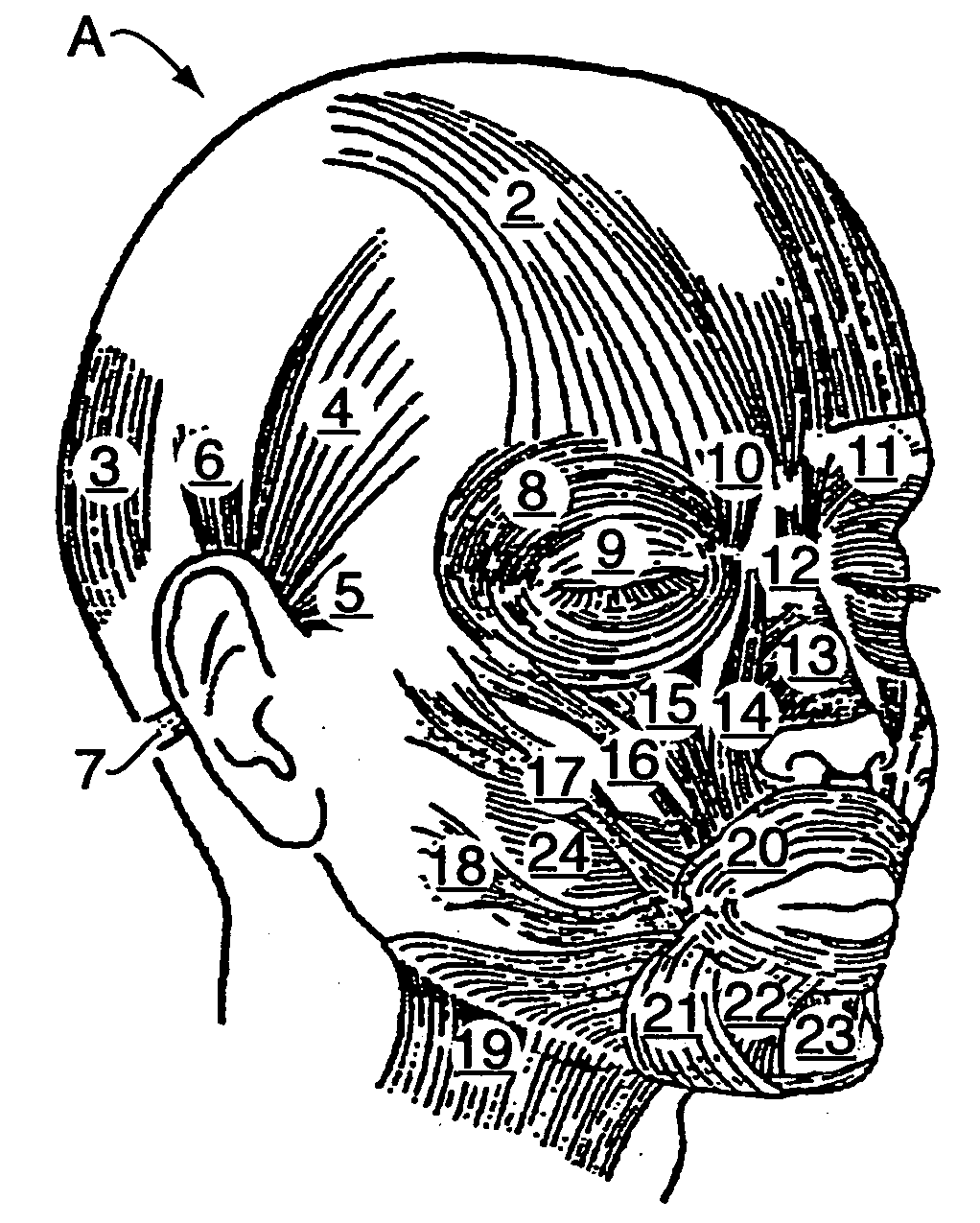 Method and apparatus for training facial muscles to reduce wrinkles