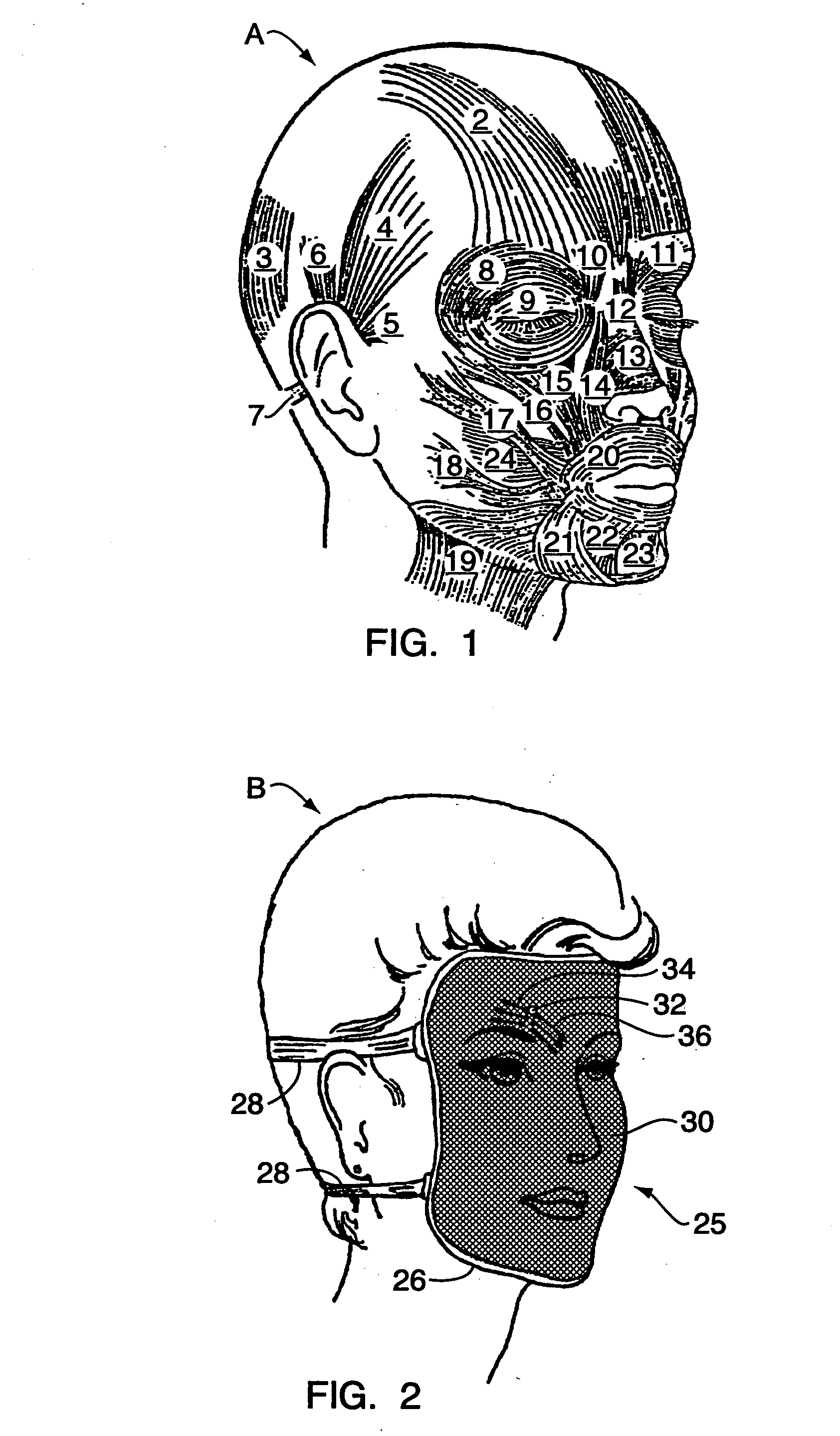 Method and apparatus for training facial muscles to reduce wrinkles