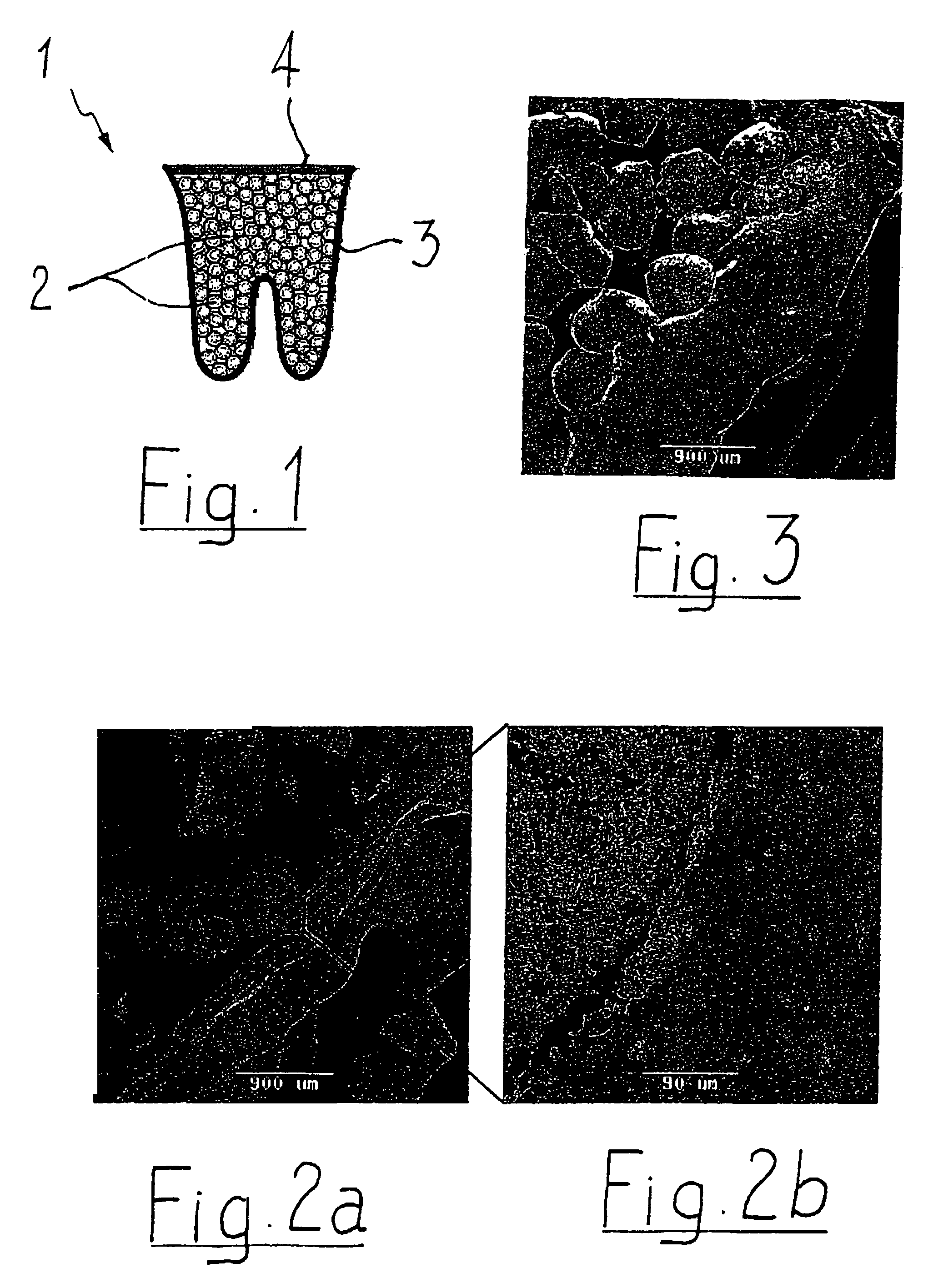 Biodegradable biocompatible implant