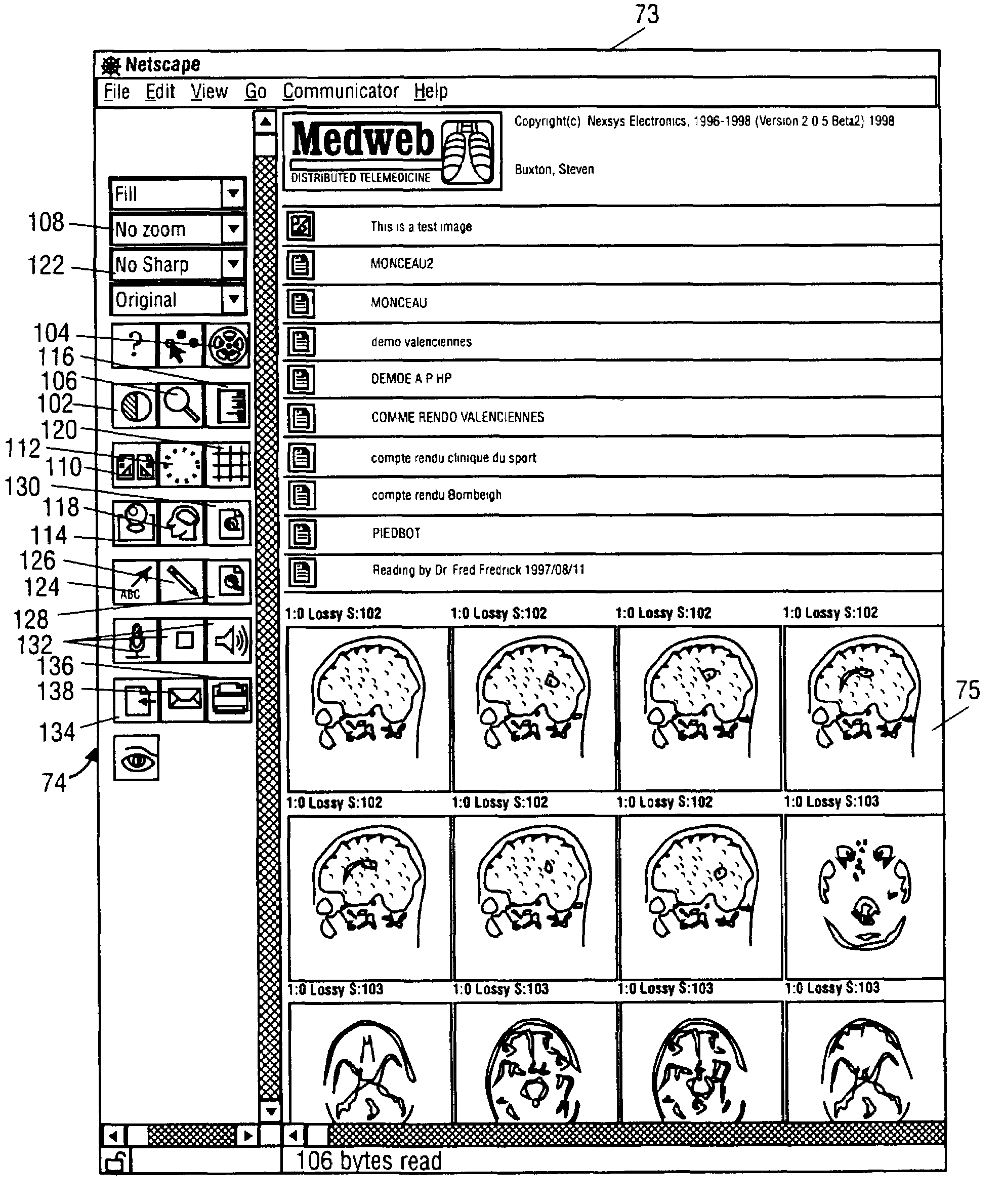 Medical network system and method for transfer of information