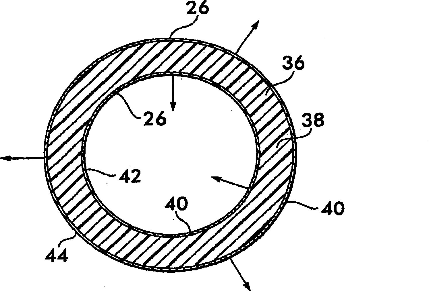 Implantable shunt or catheter enabling gradual delivery of therapeutic agents