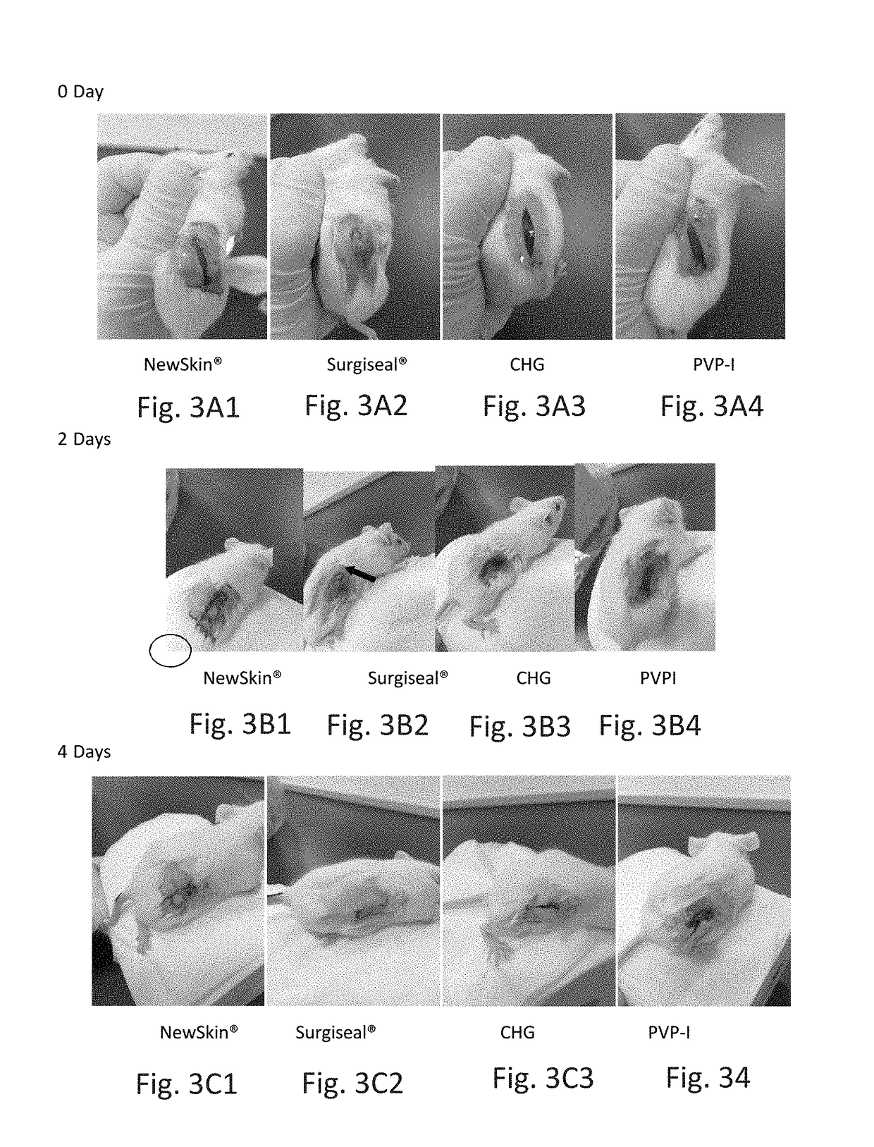 Novel rapid-deposition thin-film forming compositions as effective wound care treatment