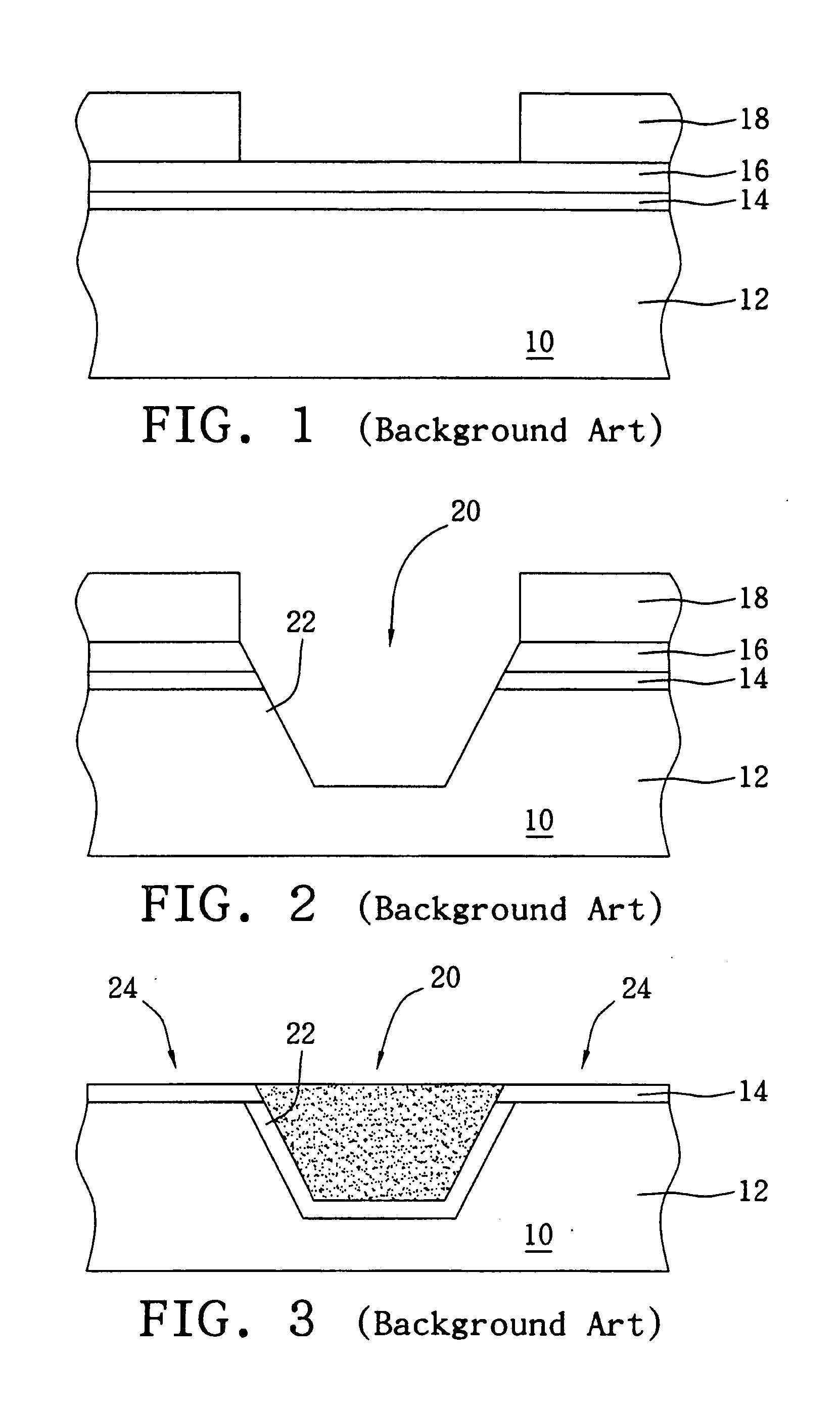 Etching system and method for treating the etching solution thereof