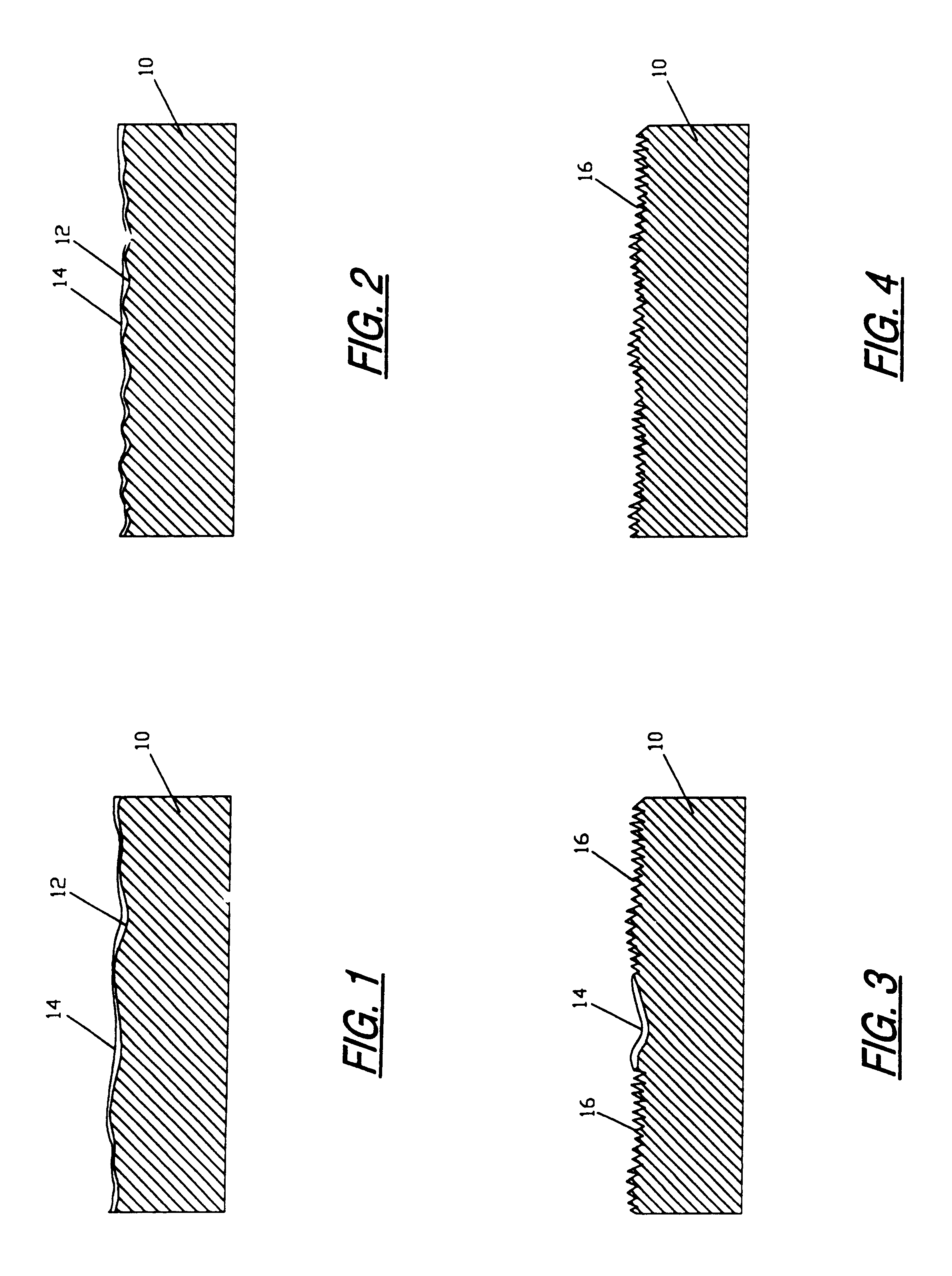 Implant surface preparation