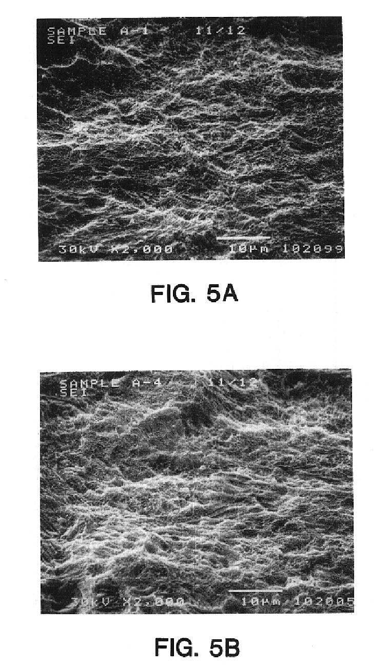 Implant surface preparation