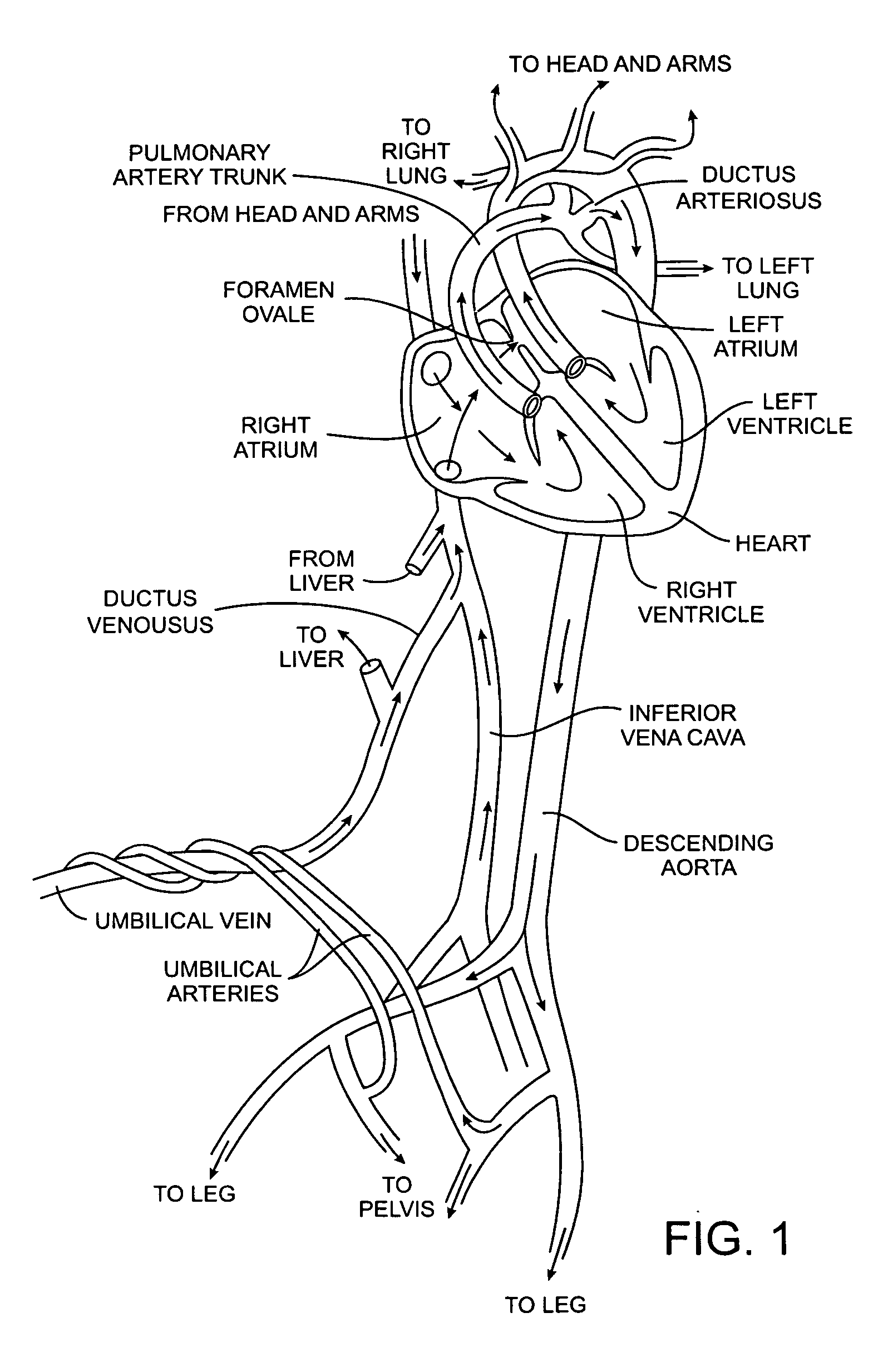 Methods and apparatus for treatment of patent foramen ovale