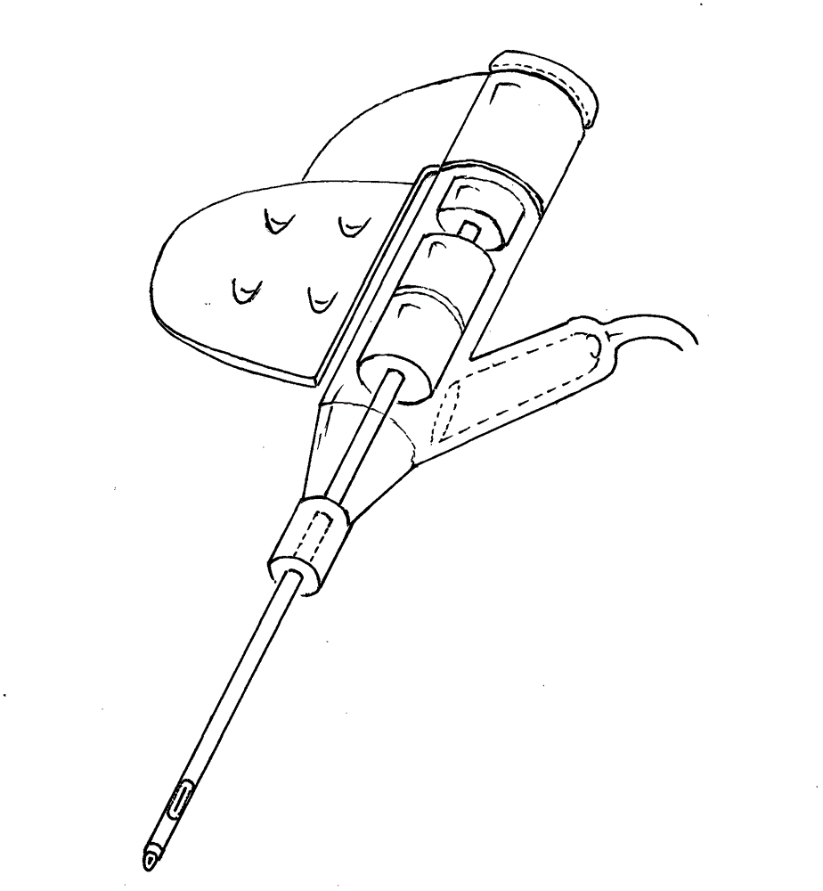 Disposable single hand insertion tube type vein detaining needle