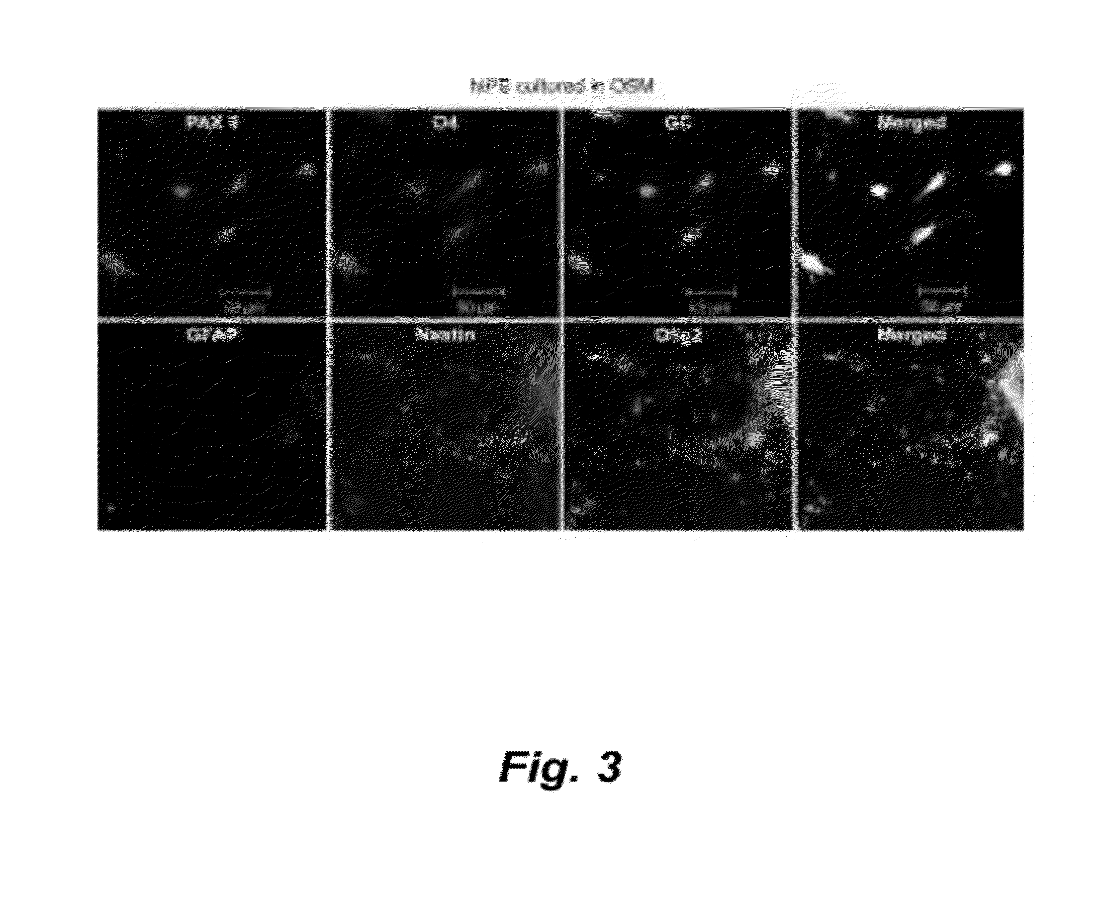 Culture system for stem cell propagation and neural and oligodendrocyte specification