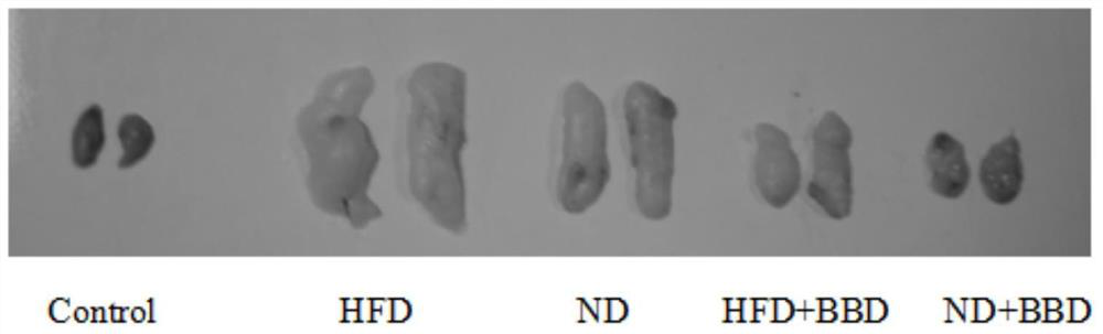 Application of Babaodan in the preparation of medicine for treating non-alcoholic fatty liver