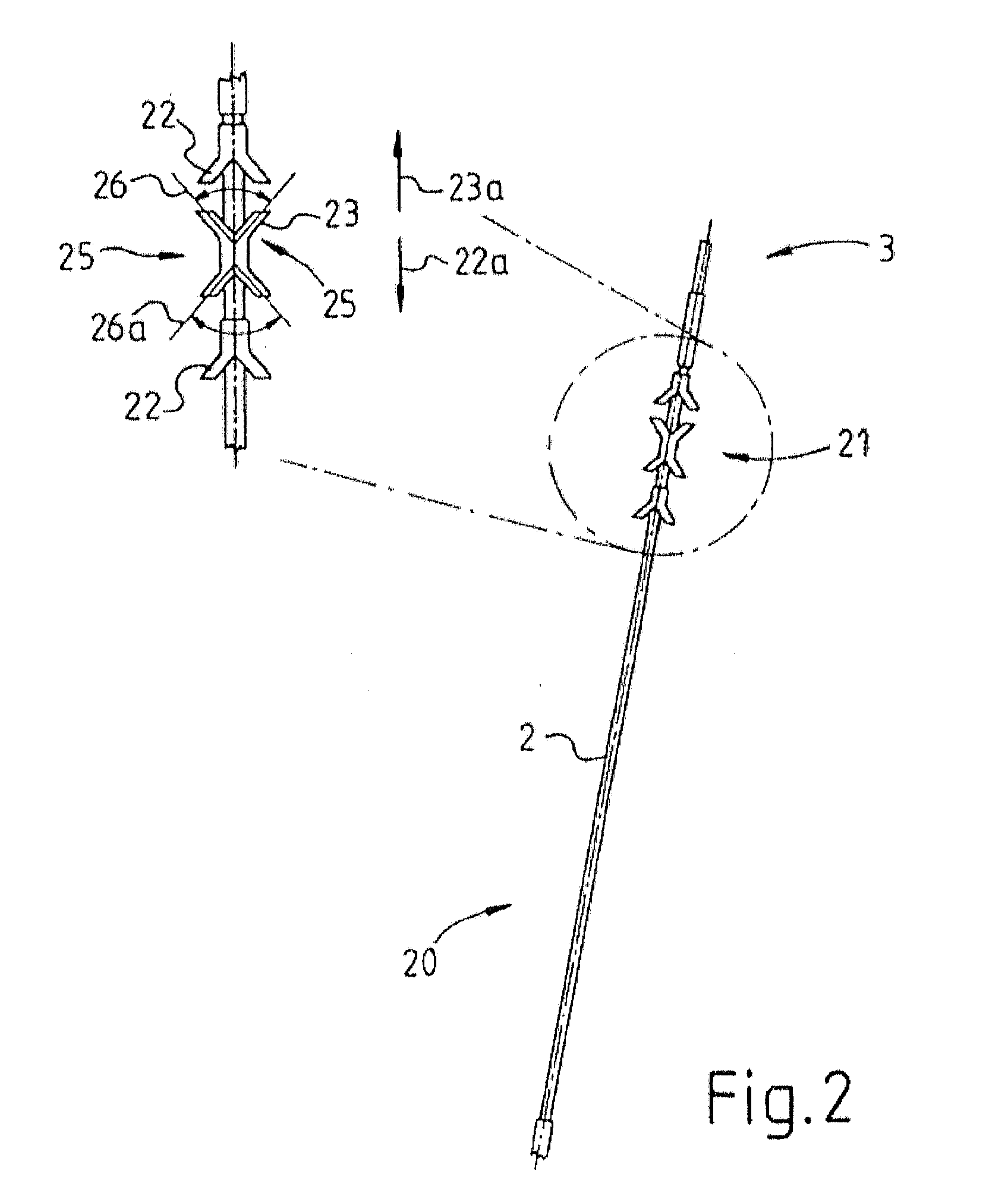 Sacral neuromodulator