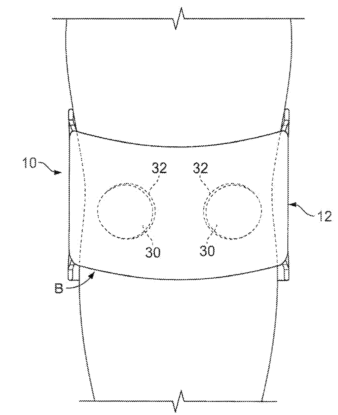 Therapeutic knee brace having pressure applicators